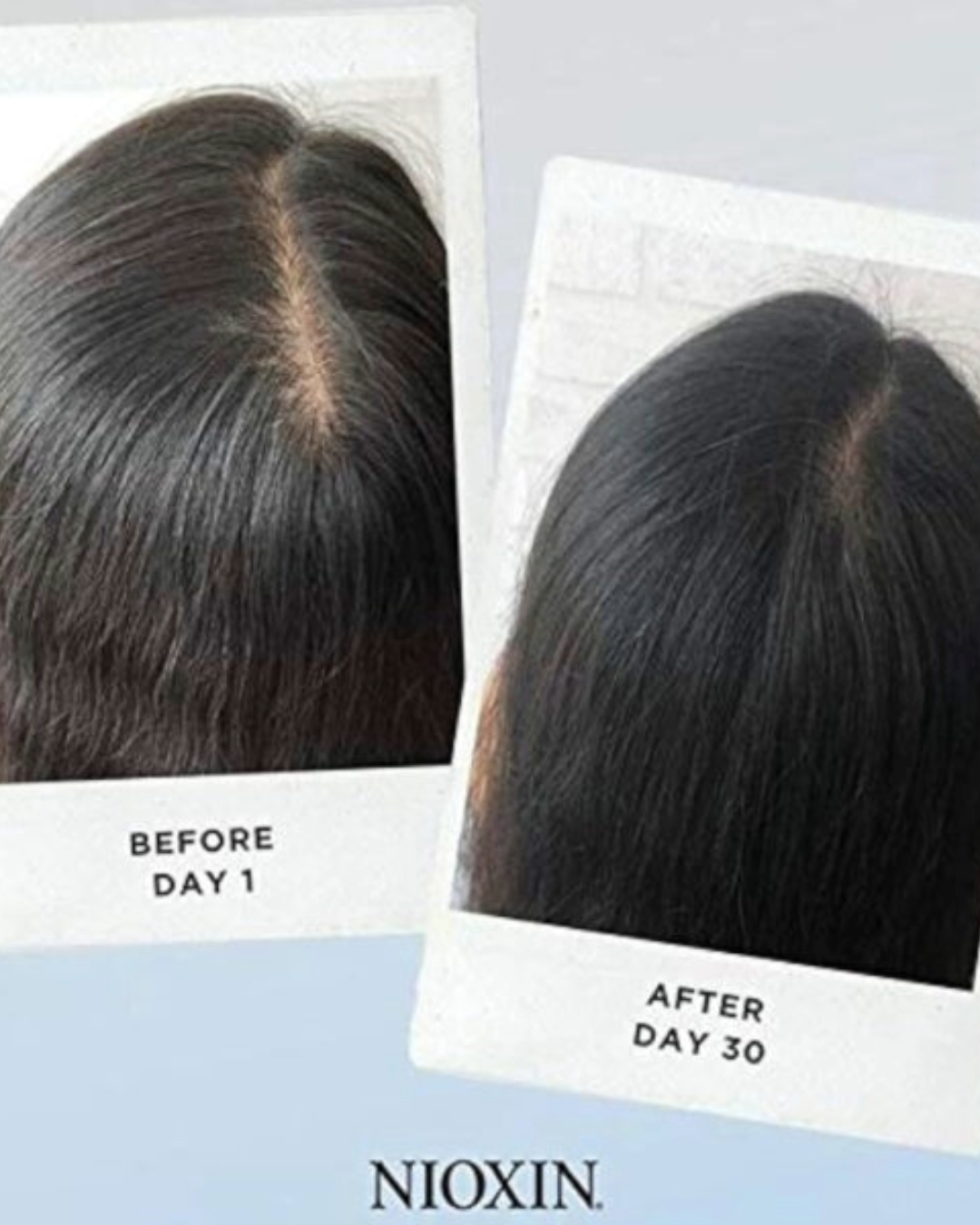 Scalp Analysis with Nioscope Technology at Studio 74 Salon in Peterborough
